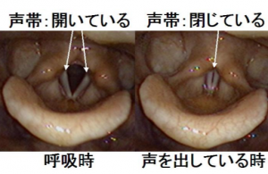 ロキソニン飲み過ぎの恐怖！隠れた腎障害リスクと緊急の対処法