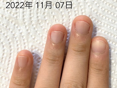 【最新】 爪 が 早く 伸びる 方法 最新ニュース速報 2026 #810