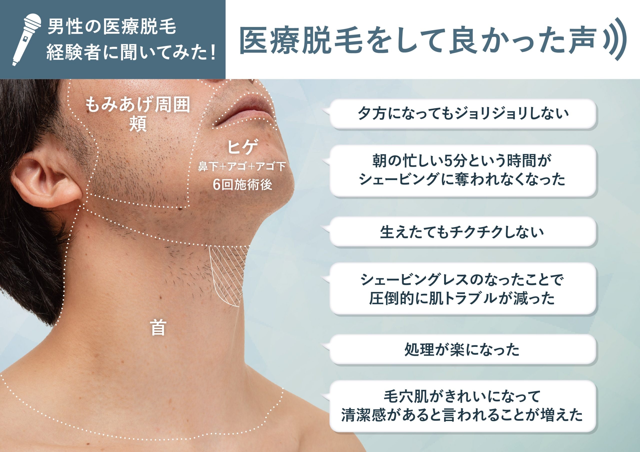 湘南美容ヒゲ脱毛で後悔？効果ない噂の真相と2026最新料金・評判検証