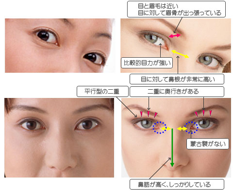 「不自然な目元」の境界線はどこ？2026年、美容整形トレンドの劇的変化と「やりすぎ」と囁かれるメディアの裏側