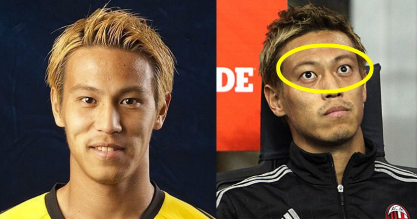 本田圭佑が語るバセドウ病の真相と首の傷跡、挑戦を続ける現在