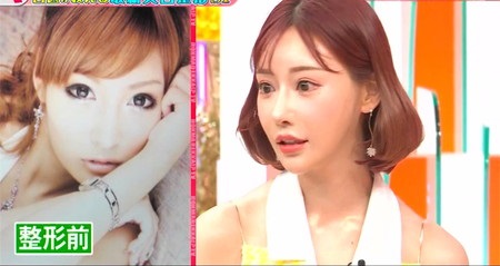 【真相】 明日 花 キララ 整形 前 私服＆私生活最新ショット #691