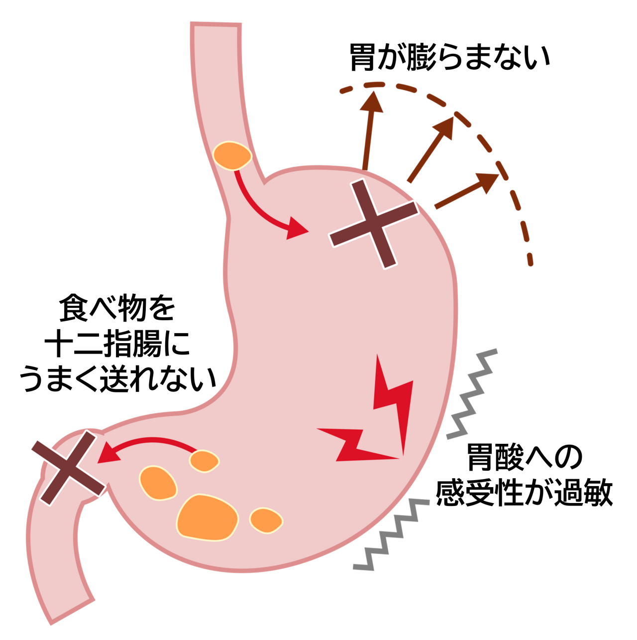 みぞおちが痛い原因とは？キリキリ激痛の背後にある重大病と見極め方
