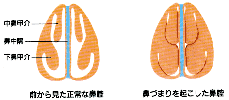 2026年の新国民病？「鼻の下のニオイ」に悩む人が急増する意外な原因と最新の解決策