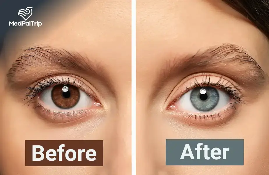 How Do You Change Your Eye Colour