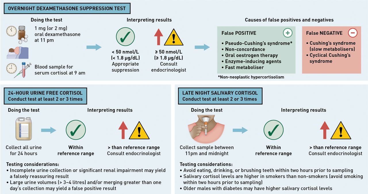 How Do You Test for Cushing Syndrome