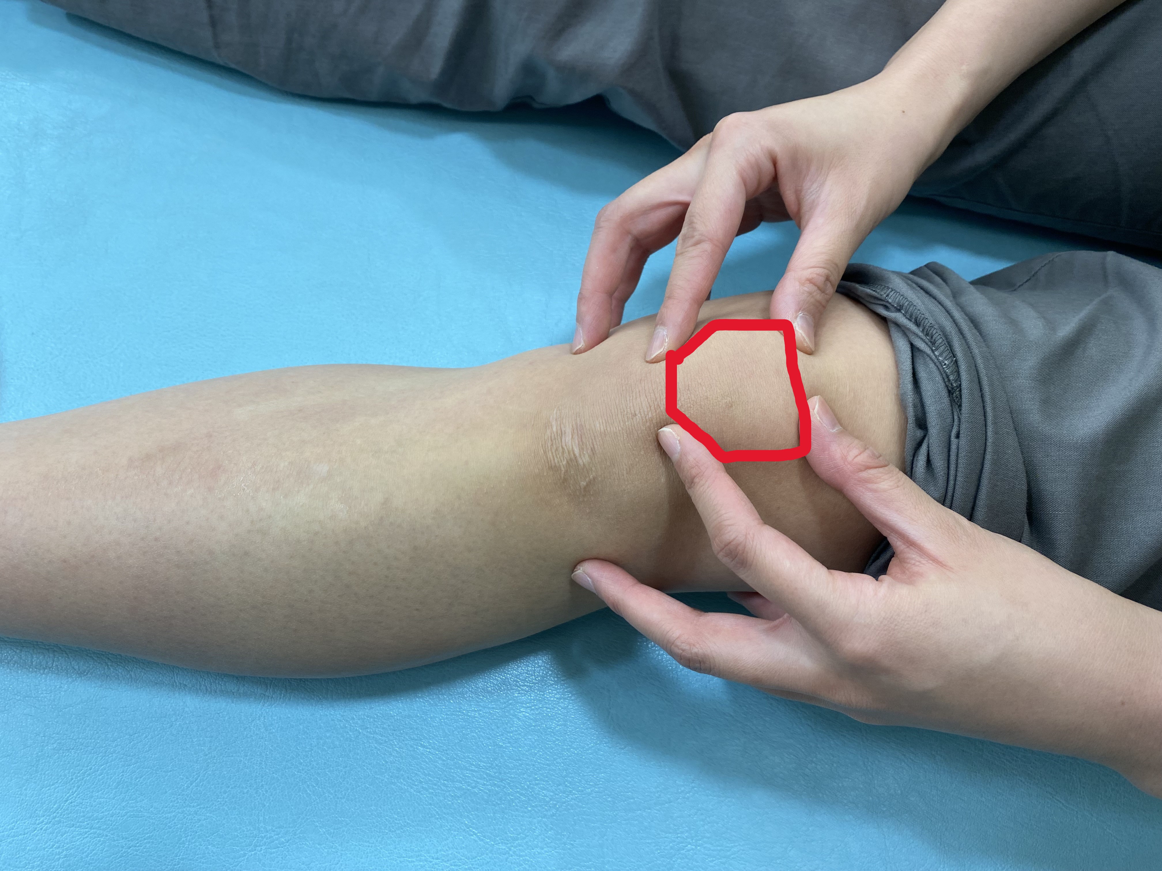 膝の皿が動くのは異常？グラグラ違和感とポキポキ音の正体を徹底解剖