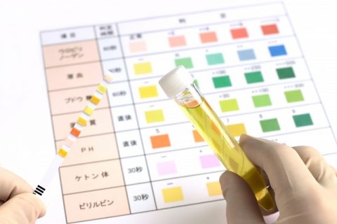 【画像あり】 尿 検査 生理 中 最新情報まとめ 2026 #632