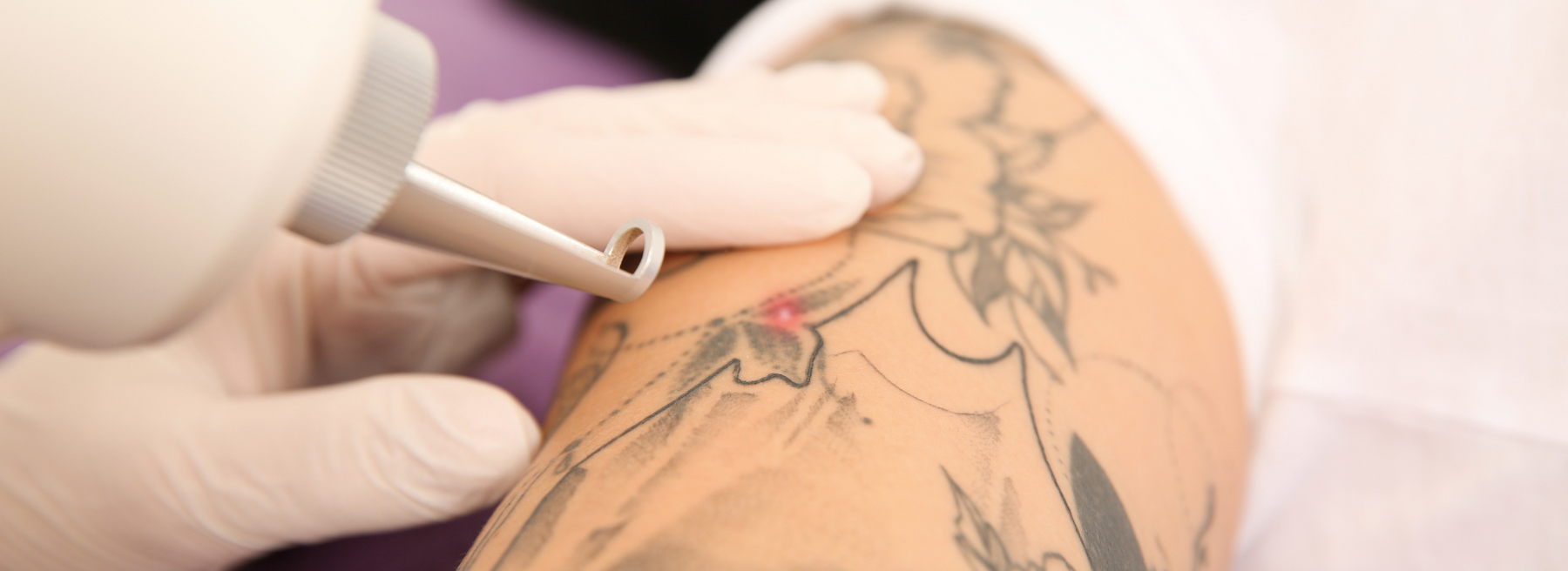 Ink'd London Tattoos Piercings & Laser Tattoo Removal