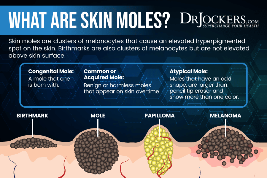How to Prevent Moles on Skin