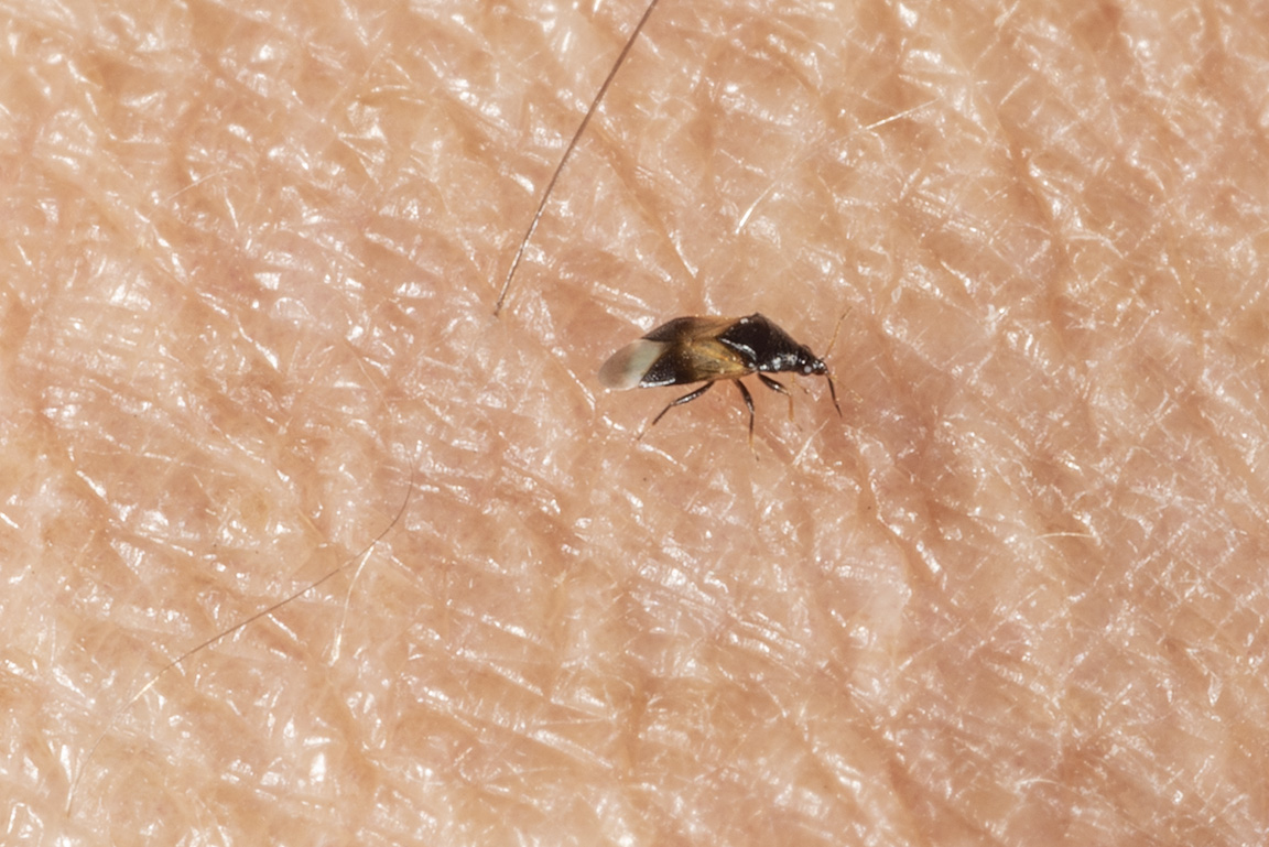 Tiny Long Black Bugs on Skin