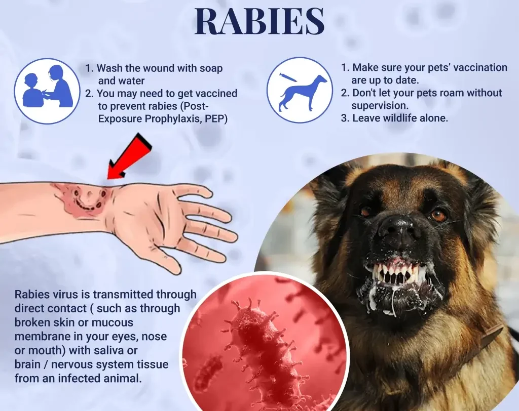 Can Humans Get Rabbies
