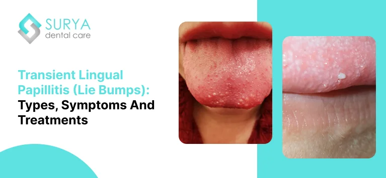 Tiny Red Bumps Tip of Tongue