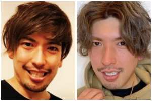 Exitりんたろー。が体現する「美容整形」のリアル：2026年、男たちが鏡に向き合う本当の理由