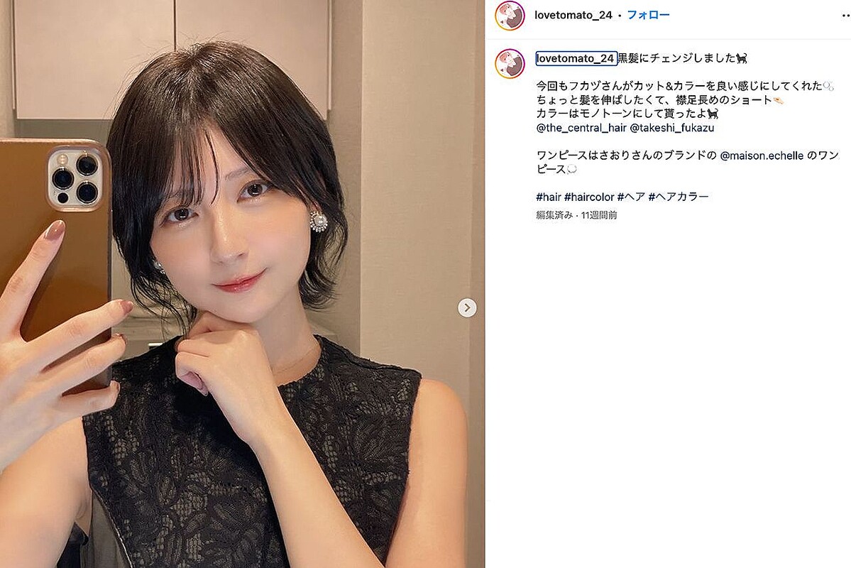 Teruとこばしり。の知られざる関係！音楽と美容を繋ぐ最新真相