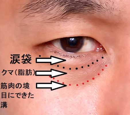 「涙袋がない」は本当にデメリット？2026年、アジアの美意識を揺るがす「フラットアンダーアイ」新潮流の真実