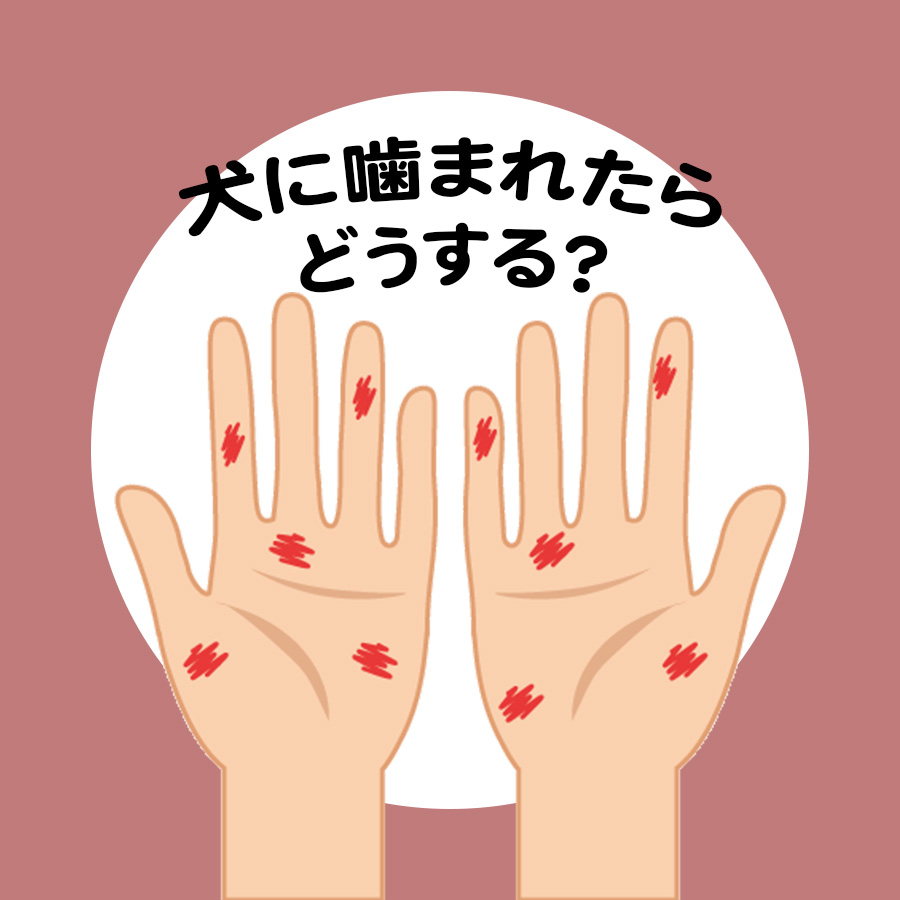 犬に噛まれたら何科を受診？放置が命取りになる理由と損害賠償の真実