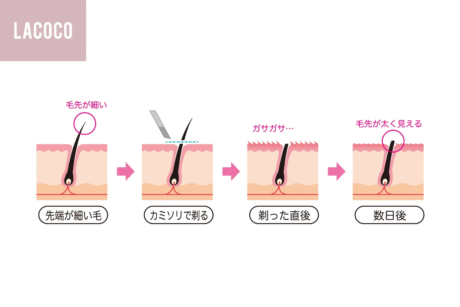 毛を剃ると濃くなる噂は嘘？皮膚科医が明かす錯覚の正体と正しいケア