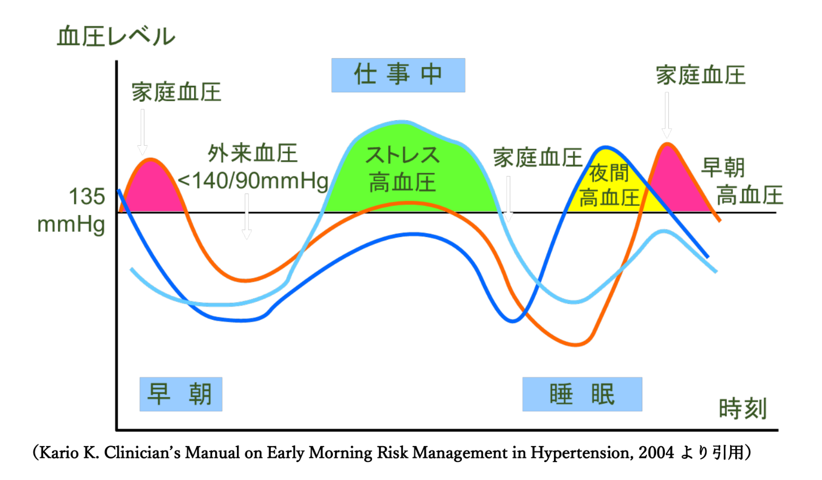 朝の血圧が高く夜は低い？危険な早朝高血圧の正体と心筋梗塞リスク
