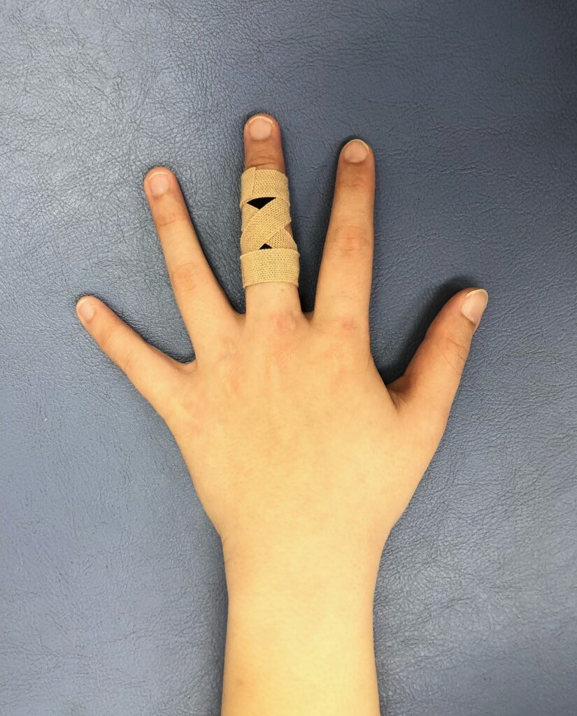 指の第二関節テーピング術！突き指や痛みを防ぐプロの巻き方徹底解説