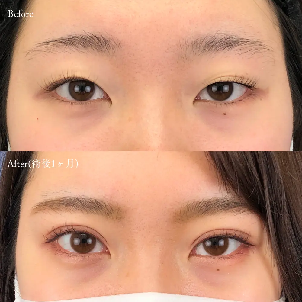 左右で異なる瞳の怪しい魅力！雌雄眼俳優がスクリーンを狂わせる