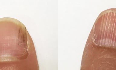 【動画まとめ】 爪 に 黒い 縦 線 最新ニュース速報 2026 #999
