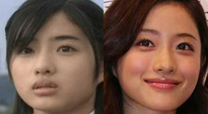 石原さとみの整形疑惑を徹底検証！昔の画像と比較で見えた垢抜けの真実