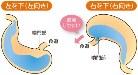 親の認知症は子に伝わるのか？最新研究が明かす遺伝リスクと真実